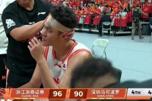 嚇人！布朗落地一肘砸在王浩然頭上 后者直接頭破血流纏上繃帶